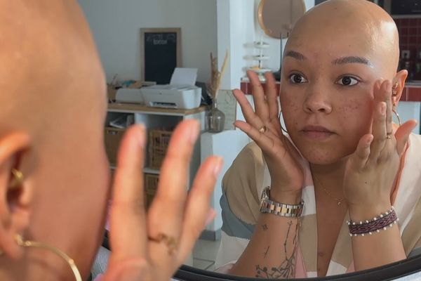 Cancer du sein : témoignage de Manon, la prise en charge intégrale des soins pourrait soulager les patientes