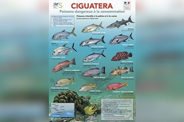 Ciguatera