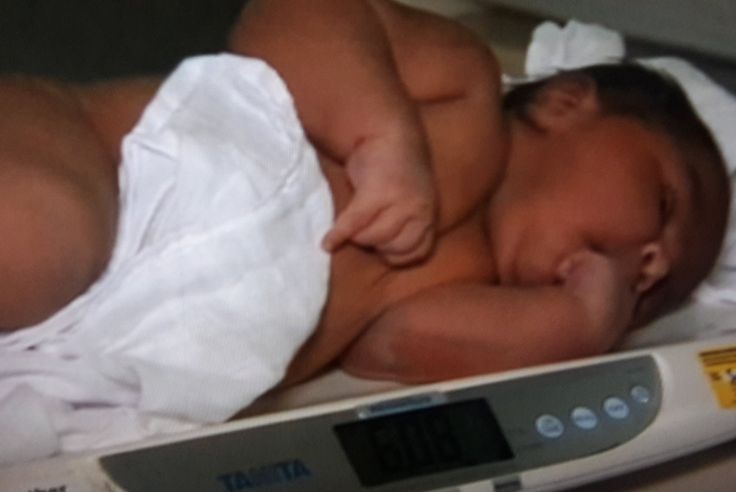 Un Bebe De Plus De 6 Kgs Ne En Australie Wallis Et Futuna La 1ere