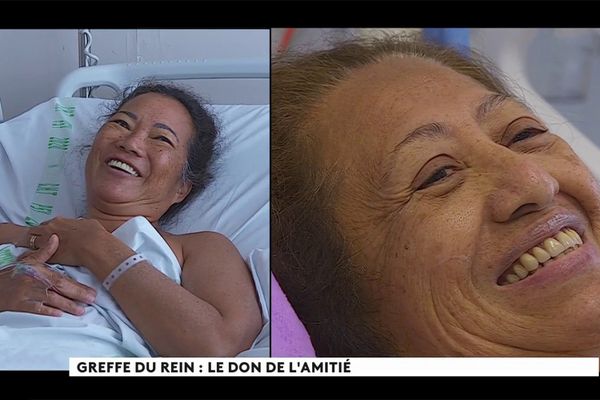 Maria, la donneuse (à gauche) et Maréva, la receveuse (à droite), tout sourire, au lendemain de la greffe de rein réussie à l'hôpital de Taaone en Polynésie.