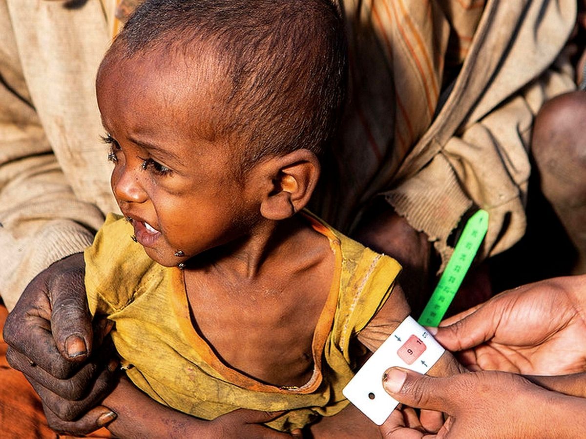 Madagascar : la famine menace un demi-million d'enfants de moins de 5 ans -  Réunion la 1ère